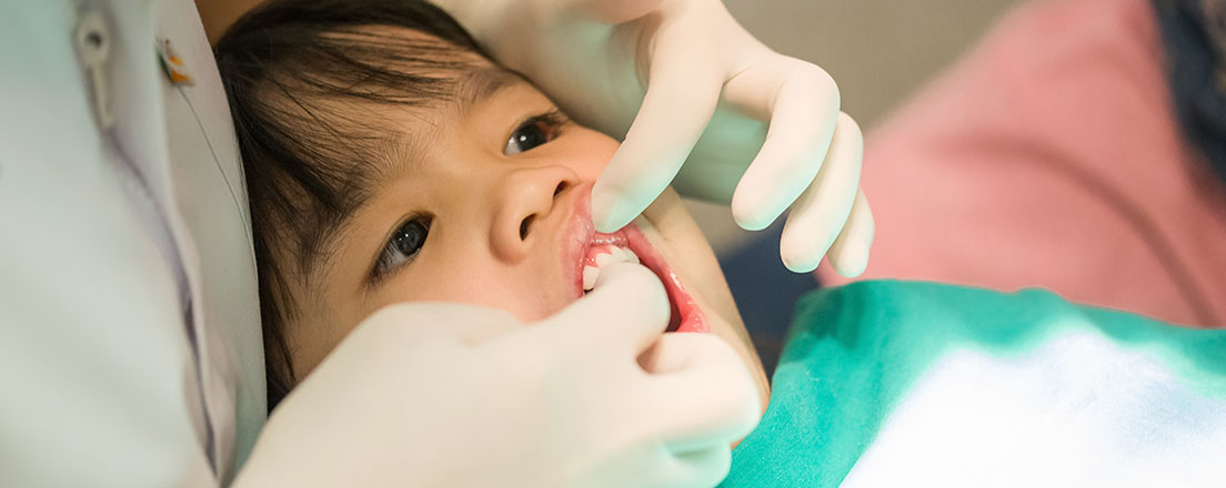 Westgrove Dental - Dental Fluoride